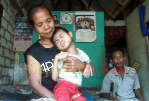 anak buruh tani menderita polio